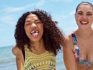 Brand Primark Dipuji karena Tampilkan Model yang Gigi Depannya Ompong Brand Primark Dipuji karena Tampilkan Model yang Gigi Depannya Ompong