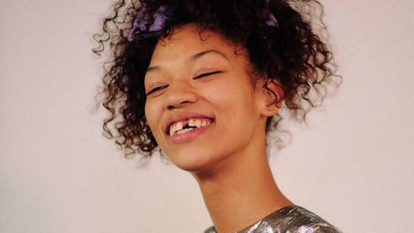 Potret Symone Lu, Model yang Jadi Terkenal karena Punya Gigi Ompong