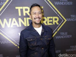 Kocak! Dibilang Oplas Hidung, Tora Sudiro Balas Netizen Ini Kocak! Dibilang Oplas Hidung, Tora Sudiro Balas Netizen Ini