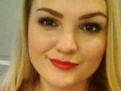 Wanita Norwegia Tewas Akibat Rabies Usai Digigit Anak Anjing di Filipina