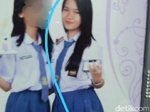 Derita Fera Dimutilasi Oknum Tentara