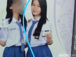 Derita Fera Dimutilasi Oknum Tentara