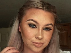 Remaja Ini Dandan 2 Jam Setiap Hari, Begini Kondisi Kulit Aslinya