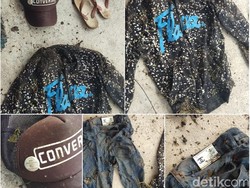 Ini Ciri-ciri Kerangka Manusia yang Ditemukan di Kebun Kopi Cimaung