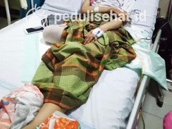 Kaki Kanan Perempuan Ini Harus Diamputasi Akibat Terbentur Meja