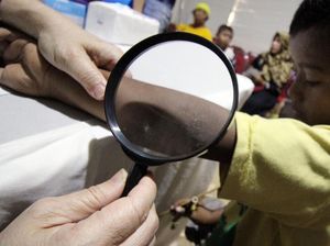 Warga Antusias Periksa Kesehatan Kulit