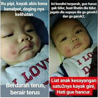 Tanggapan Dokter Reisa Soal Baby Ryu yang Viral