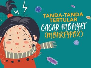 Infografis: Tanda-tanda Tertular Cacar Monyet