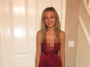 Tagihan Rumah Sakit Rp 1 M, Gadis Ini Tak Bisa keluar dari Dubai