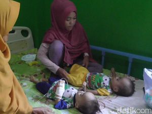 Bayi Kembar di Polman Idap Gizi Buruk, Ortu Kesulitan Biayai Perawatan Bayi Kembar di Polman Idap Gizi Buruk, Ortu Kesulitan Biayai Perawatan