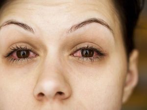 Studi Sebut Menangis di Jam 7-10 Malam Bisa Bantu Turunkan Berat Badan Studi Sebut Menangis di Jam 7-10 Malam Bisa Bantu Turunkan Berat Badan
