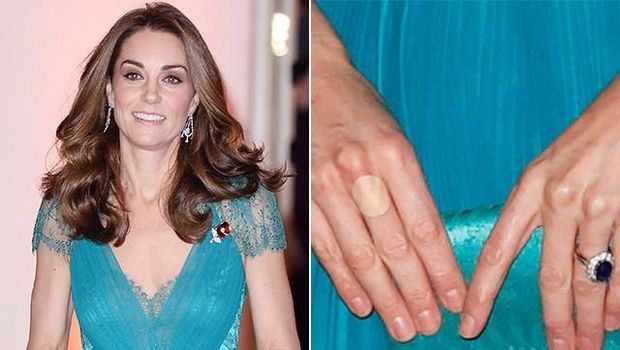 Kate Middleton