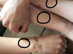 Viral, Wanita Ramai-ramai Pamer Freckle di Pergelangan Tangan