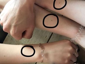 Viral, Wanita Ramai-ramai Pamer Freckle di Pergelangan Tangan Viral, Wanita Ramai-ramai Pamer Freckle di Pergelangan Tangan