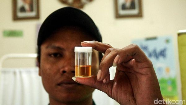 Sopir Bus Jalani Tes Kesehatan di Terminal Grogol