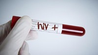 Ciri-ciri HIV pada Pria yang Harus Diwaspadai, Mirip Flu Biasa!