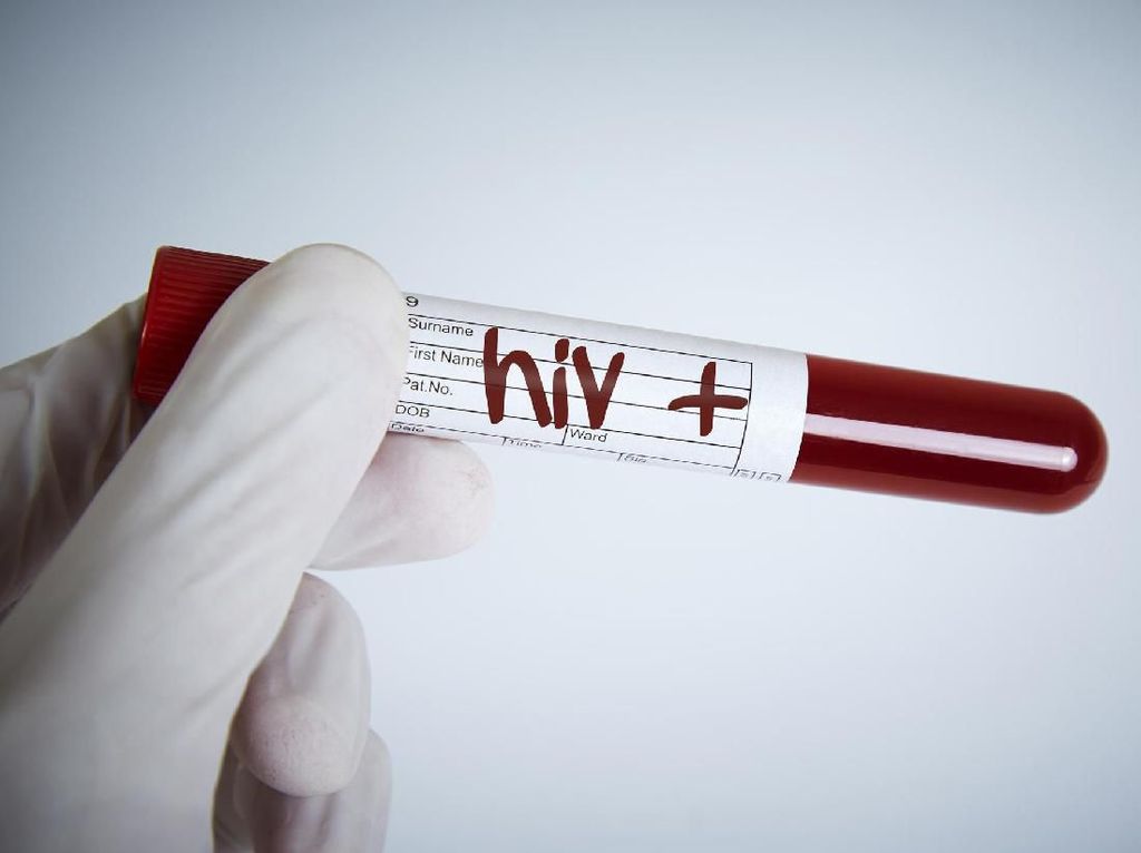 Pasien HIV dan Leukemia Dinyatakan Sembuh Berkat Terapi Sel Punca Pasien HIV dan Leukemia Dinyatakan Sembuh Berkat Terapi Sel Punca
