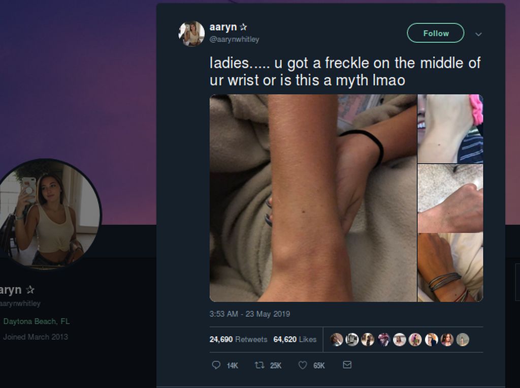 Viral Freckles Mirip di Pergelangan Tangan Wanita, Mitos atau Fakta? Viral Freckles Mirip di Pergelangan Tangan Wanita, Mitos atau Fakta?