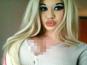 Oplas Agar Mirip Barbie, Transformasi Wanita Ini Malah Dicibir Monster