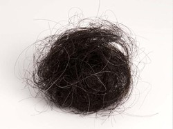 Ajaib! Gumpalan Rambut Seberat 2 Kg Diangkat dari Perut Remaja Ini