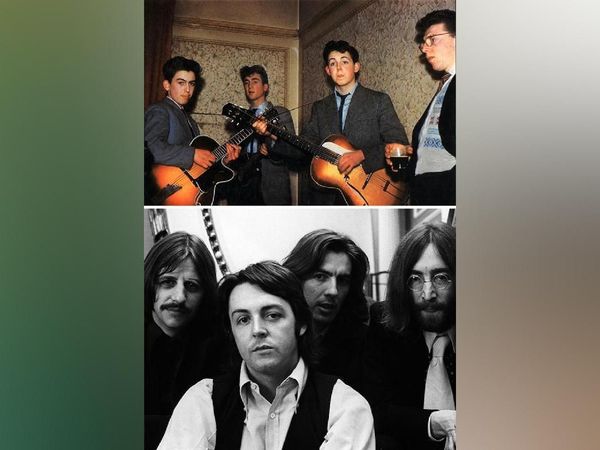 Penampilan Cupu Band Top Dunia Sebelum Tajir dan Terkenal