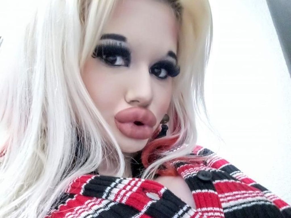 Bibir Jumbo Mirip Monster, Wanita Ini Obsesi Punya Bibir Terbesar di Dunia Bibir Jumbo Mirip Monster, Wanita Ini Obsesi Punya Bibir Terbesar di Dunia