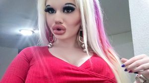 Potret Wanita yang Terobsesi Barbie, Setahun Operasi Plastik 15 Kali
