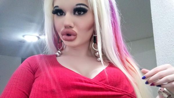 Potret Wanita yang Terobsesi Barbie, Setahun Operasi Plastik 15 Kali