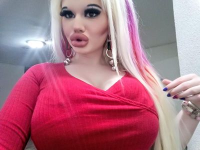 Potret Wanita yang Terobsesi Barbie, Setahun Operasi Plastik 15 Kali