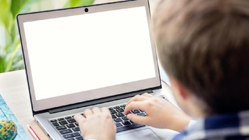 Keseringan Pakai Laptop di Pangkuan, Kulit Bocah Ini 'Gosong'