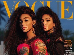 Pertamakalinya 2 Model dengan Kulit Belang Jadi Sampul Majalah Vogue Arab