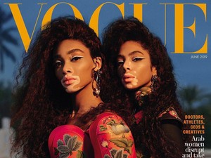 Pertamakalinya 2 Model dengan Kulit Belang Makara Sampul Majalah Vogue Arab Pertamakalinya 2 Model dengan Kulit Belang Makara Sampul Majalah Vogue Arab