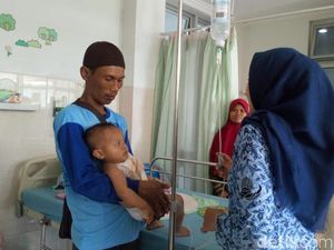 Balita 15 Bulan di Ponorogo Terluka Bakar Setelah Ketumpahan Air Panas