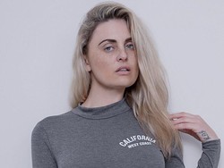 Mantan Model Pura-pura Gila Untuk Dapat Operasi Plastik Gratis