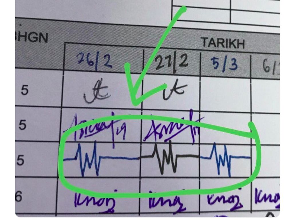 Viral Tanda Tangan yang Disebut Netizen Seperti Detak Jantung Viral Tanda Tangan yang Disebut Netizen Seperti Detak Jantung