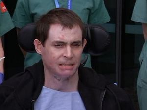 Pertama di Dunia, Dokter Australia Tumbuhkan Kulit Asli di Lab