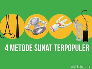 Plus Minus Berbagai Metode Sunat, Laser hingga Klem Plus Minus Berbagai Metode Sunat, Laser hingga Klem