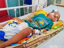 Tolong! Bocah Radika Koma karena Radang Otak