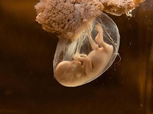 Gila! China Kembangkan Rahim Buatan dengan Robot Perawat Janin