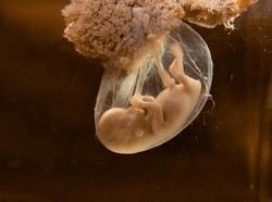 Gila! China Kembangkan Rahim Buatan dengan Robot Perawat Janin