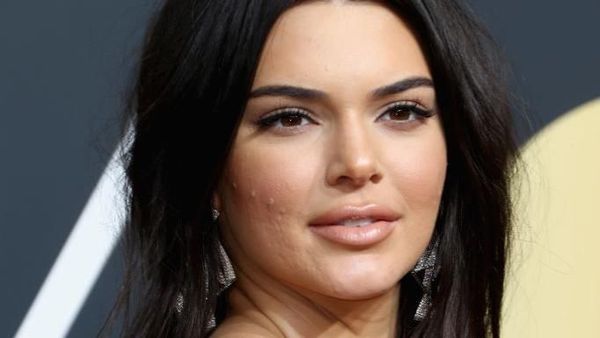 Momen saat Wajah Kendall Jenner Tak Semulus Biasanya, Ditumbuhi Jerawat