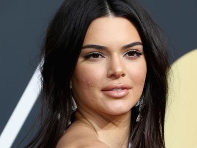 Momen saat Wajah Kendall Jenner Tak Semulus Biasanya, Ditumbuhi Jerawat