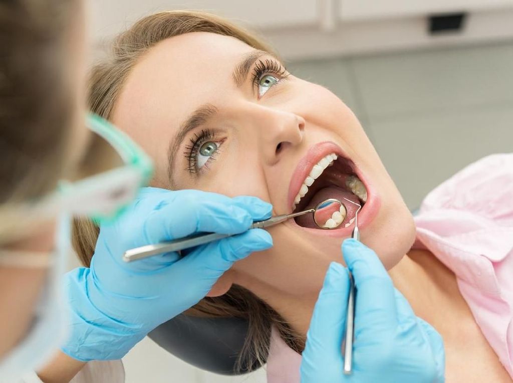 Ini 4 Mitos Umum dari Bleaching Gigi