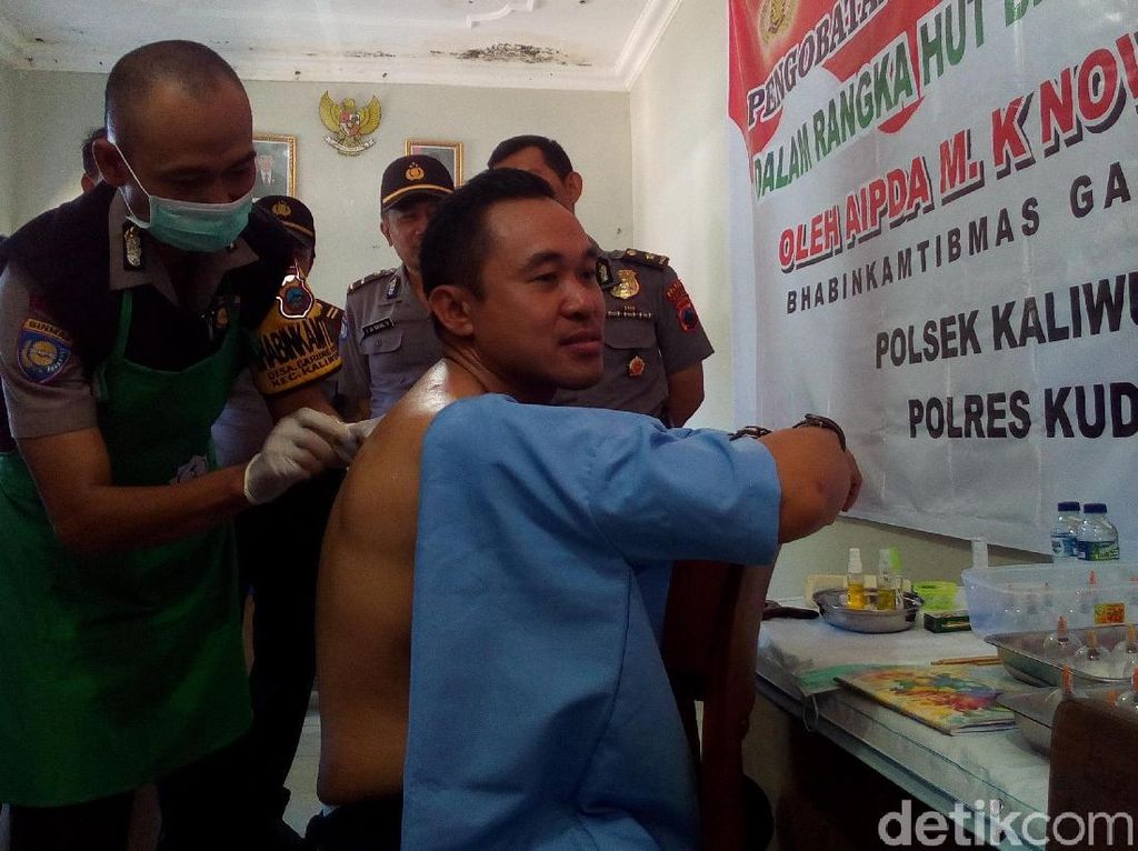 Polisi di Kudus Ini Ahli Bekam, Obati Warga Secara Gratis Polisi di Kudus Ini Ahli Bekam, Obati Warga Secara Gratis
