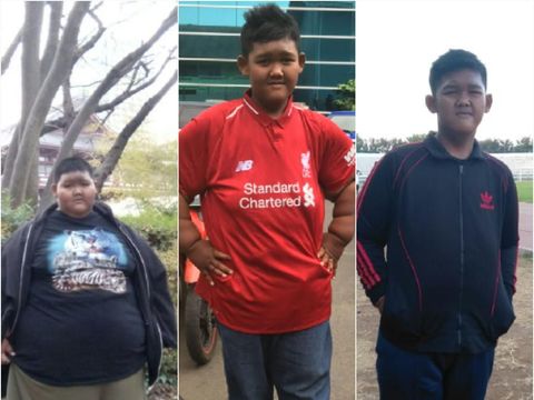 Bocah Obesitas Aria Permana Susut 110 Kg Berkat Ade Rai, Ini Fotonya Sekarang