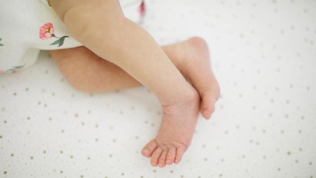 Cara Mengatasi Kaki X Cara Mengatasi Kaki X