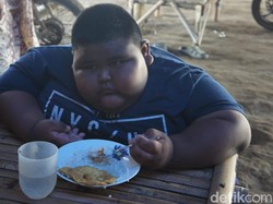 Satia, Bocah 7 Tahun Berbobot 97 Kg Bakal Dibawa ke RSUD Karawang