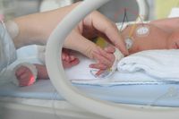 Bunda, Begini Cara Tepat Merawat Bayi Prematur di Rumah