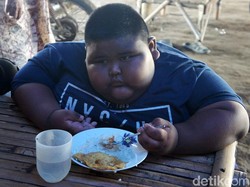 5 Fakta Satia Putra, Bocah Obesitas Ekstrem Asal Karawang yang Meninggal Dunia
