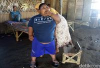 Belajar dari Satia Putra, Obesitas Bisa Ancam Nyawa Anak